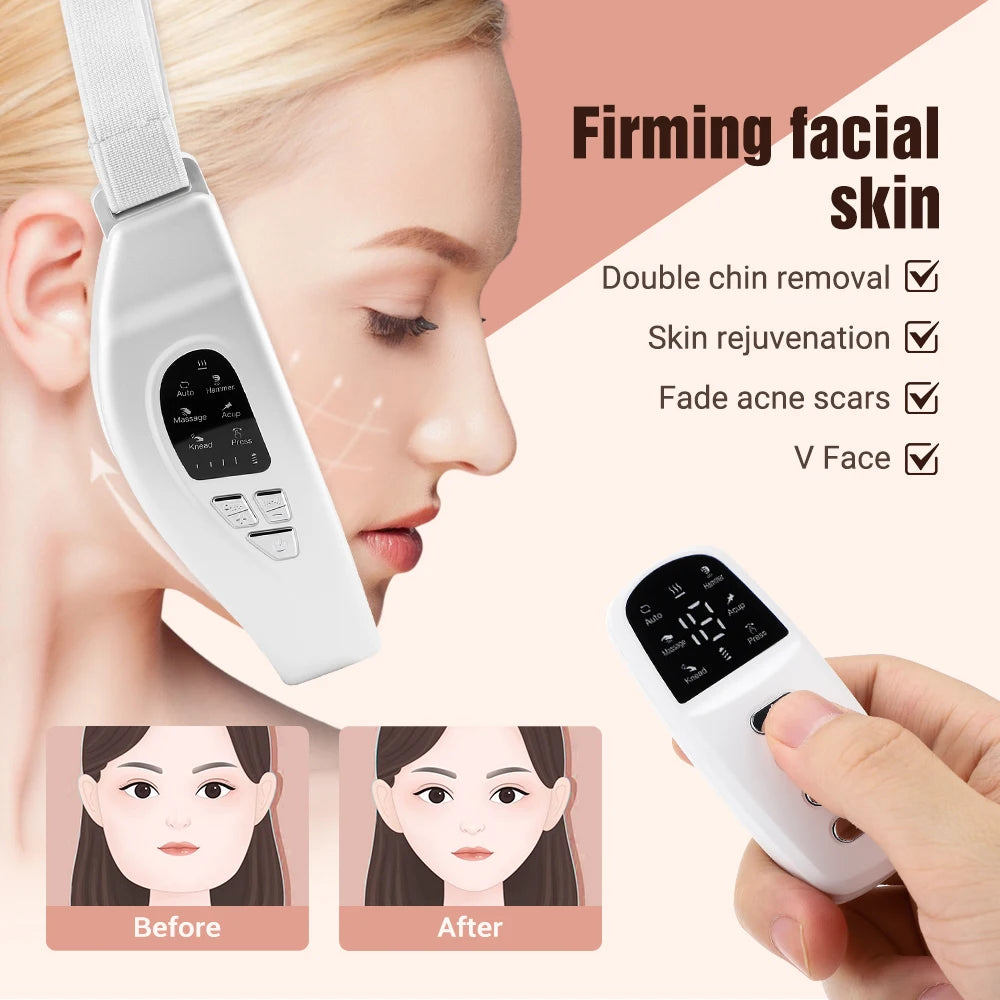 Eye Beauty Device